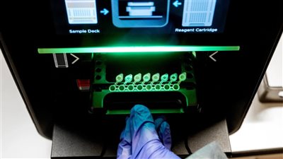 باستخدام الحمض النووي.. اختبار طبي جديد يكشف عن فيروسات جديدة