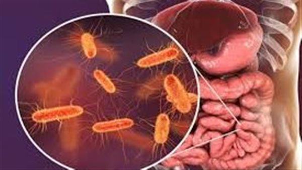  البكتيريا الإشريكية