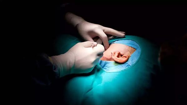 جراحة الأذن 