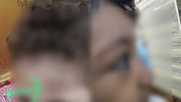 أحد الأطفال المصابين