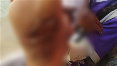 ضرب وحرق بالقدمين.. السجن سنة لعامل وزوجته بتهمة تعذيب طفلتيه في قنا