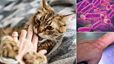 مش بسيطة.. أعراض خربشة القطط ومتى يؤخذ مصل السعار؟