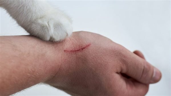 خطورة خربشة القطة