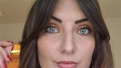 بسبب فشل عملية.. بريطانية ترفع دعوى ضد طبيب تجميل