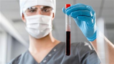 دراسة: التعرض الطويل لتلوث الهواء مرتبط بجلطات في الأوردة العميقة