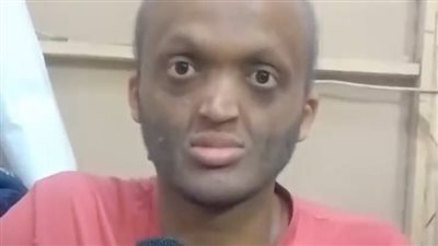 شاب يعاني من مرض الشيخوخة المبكرة: التنمر حرمني من الحياة والعمل.. ونفسي أعيش زي باقي الناس | بث مباشر