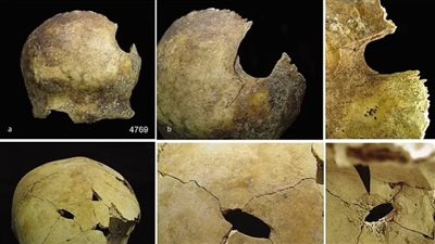 لأول مرة منذ 4500 عام.. اكتشاف بقايا ضحايا آكلي لحوم البشر في بريطانيا 