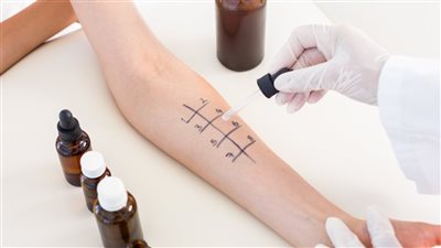 كيفية عمل اختبار حساسية للمضاد الحيوي.. من طفح جلدي إلى صدمة تحسسية