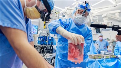 الثالثة من نوعها.. أمريكا تجري عملية زراعة كلية خنزير لسيدة   