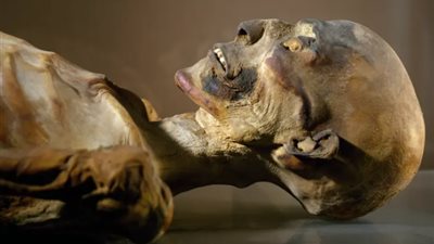 عمرها 3290 عاما.. العثور على مومياء مصرية حاملة لـ وباء الطاعون الدبلي 