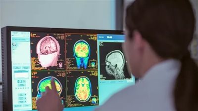 3 أمراض خطيرة تصل معدلات الوفاة بسببها إلى 100%.. تعرف عليها 