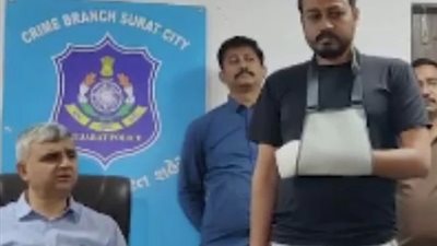 رجل يقطع 4 أصابع من يده لخجله من إخبار رئيسه برغبته في ترك وظيفته