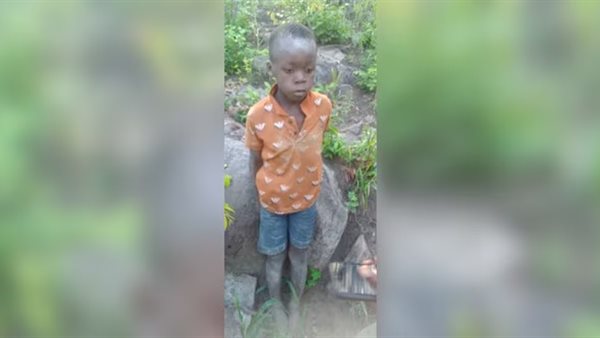 الطفل الزيمبابوي