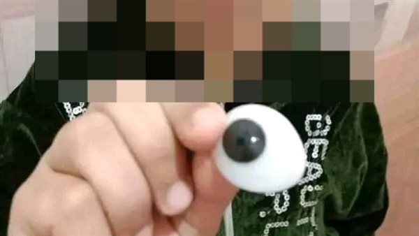 الطفلة نور مريضة