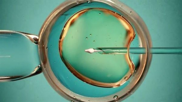  صورة تعبيرية 