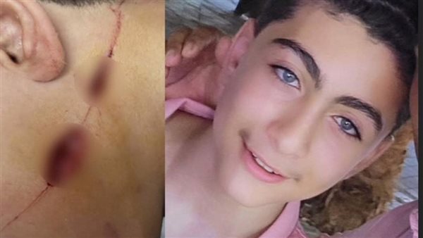 المجني عليه 