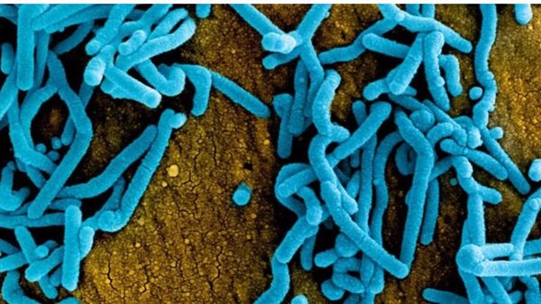 نيوروفيروس