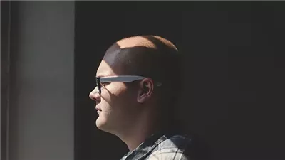 التوصل لجل جديد للشعر لعلاج الثعلبة.. تعرف على فوائده