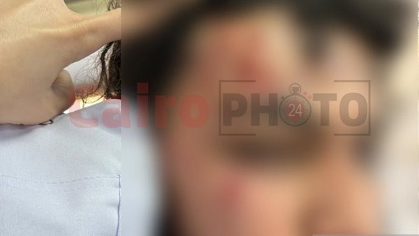 الطالب المصاب