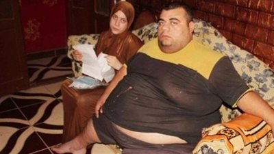 طبيب سمنة: 5 مليون مواطن مصابون بالسمنة المفرطة في مصر