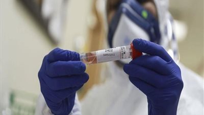 القليوبية تُسجل 11 إصابة جديدة بفيروس كورونا اليوم السبت