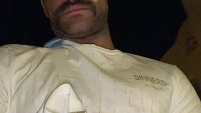 تحطم سيارة محمد مكاوي بعد تعرضه لحادث (صور)