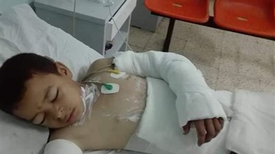 محامي ضحية التنمر والحرق بالمنوفية: إيداع المتهمين بحرق المجني عليه مؤسسة عقابية لمدة 15 يومًا