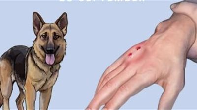 ما هو السٌعار داء الكلب وكيف ينتقل وطرق علاجه؟