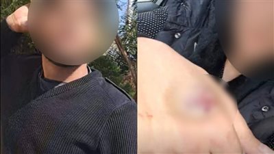 بعد نشر القاهرة 24.. بلاغ من القومي للطفولة بشأن وقعة التعدي على طبيبة من أهل زوجها بأكتوبر