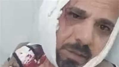 تسبب في جرح 25 سم بالرقبة.. صاحب مصنع شهير يعتدي على طليق زوجته بدمياط