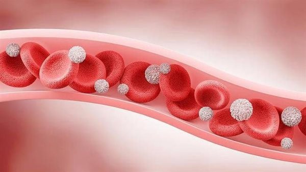  صورة تعبيرية 