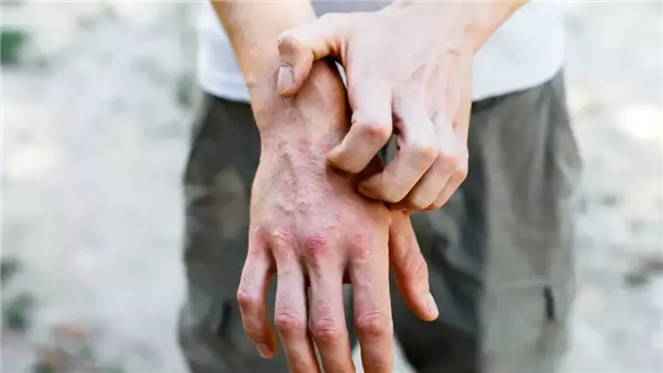  صورة تعبيرية 