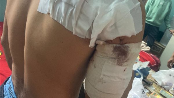 أحد المصابين في المشاجرة