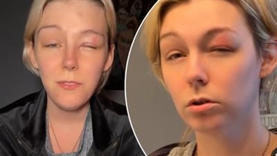 صانعة محتوى أمريكية تفقد بصرها مؤقتًا بسبب التوتر من حظر Tik Tok