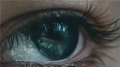 هل الكوليسترول الجيد يزيد من مخاطر الإصابة بالجلوكوما؟