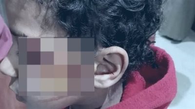 ضربوه بالموس.. إصابة طالب على يد اثنين آخرين بمدرسة ابتدائية في سوهاج