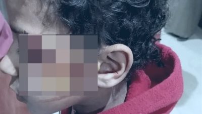 مصدر بـ تعليم سوهاج: تحويل واقعة إصابة طالب بمدرسة في طهطا للشئون القانوية