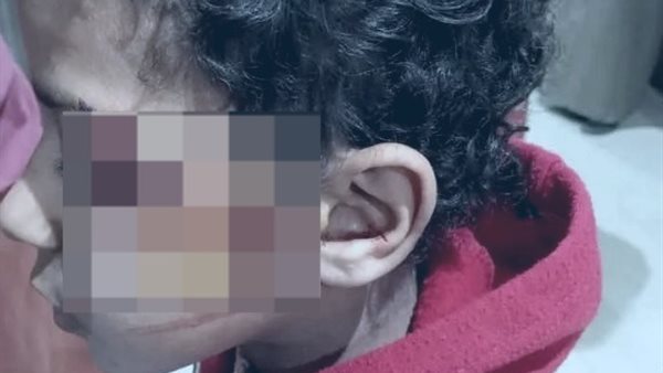 الطالب المصاب