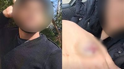 تأجيل محاكمة المتهمين بالتعدي على الطبيبة ضحية اعتداء أهل زوجها بالشيخ زايد لجلسة 19 مارس