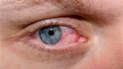 تقلبات الهرمونات قد تضر بصحة العيون.. طبيبة تكشف التفاصيل 