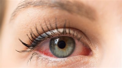 أكثر عرضة لاعتلال الشبكية.. خطورة ولادة الطفل بوزن أقل 