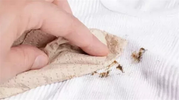 ازالة الصدأ عن الملابس