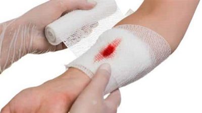 تفسير حلم جرح اليد ونزول الدم.. انتظر حياة جديدة بعد رؤيته