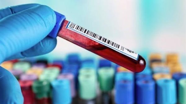 صورة تعبيرية 