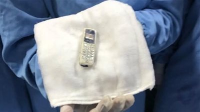  استخراج هاتف محمول من معدة سجين بالدقهلية