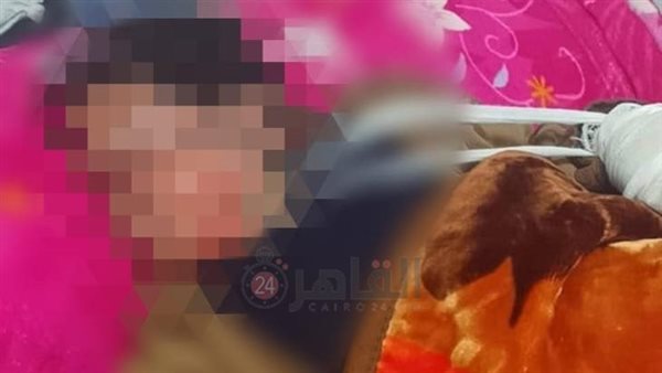 الطفلة المصابة 