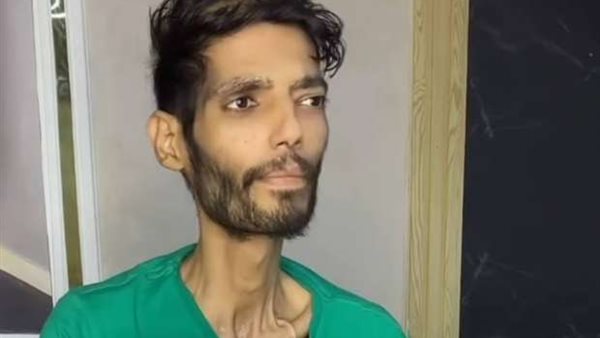 إبراهيم شيكا