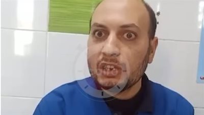 طبيب يكشف الحالة الصحية لمصابي واقعة عقر كلب ضال بالبحيرة: تحويل حالات لتلقي مصل شديد الخطورة| بث مباشر 