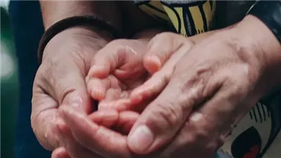 ما علاقة تعرق الأيدي بمشاعر التوتر والقلق؟ .. تعرف على التفاصيل 