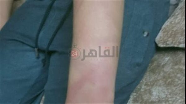 جانب من الواقعة 